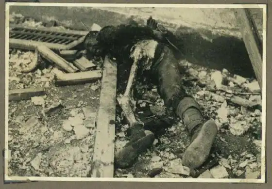 左腿肉全被日军割光吃掉的士兵