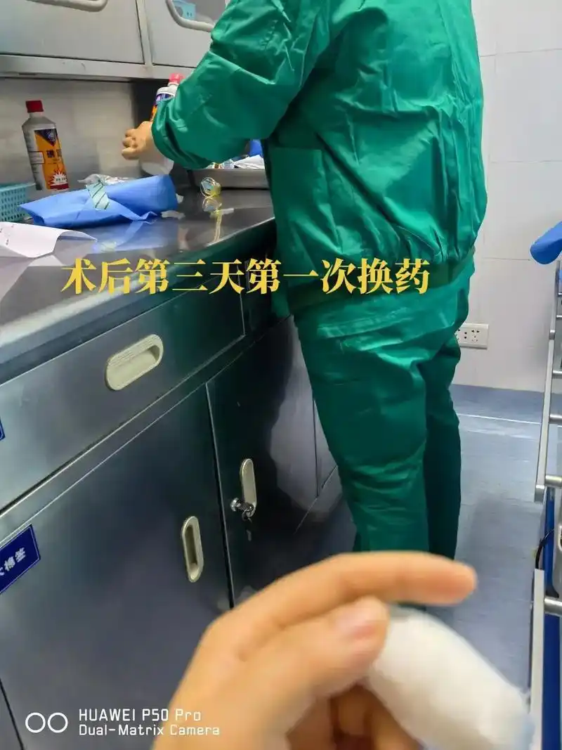 甲母痣 #甲母痣切除手术 #皮肤病  最开始因为指甲内部有 - 抖音