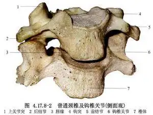 钩椎关节骨赘切除术