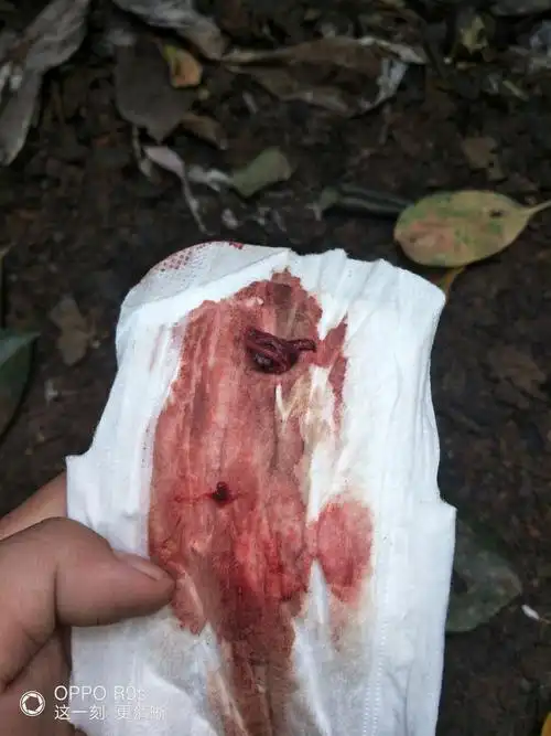 来月经经血下不来怎么办 来月经了血下不来怎么回事