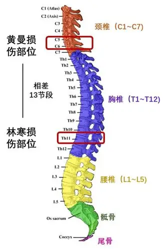 瘫痪12年,外骨骼机器使她首次站立行走 | 机智过人
