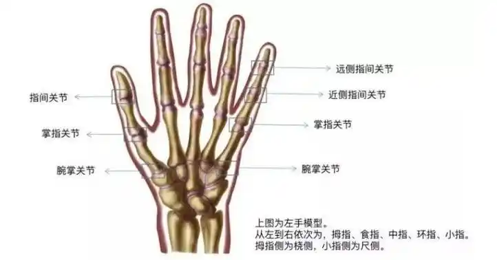 手关节痛是类风湿还是骨关节炎原来区别竟然这么大