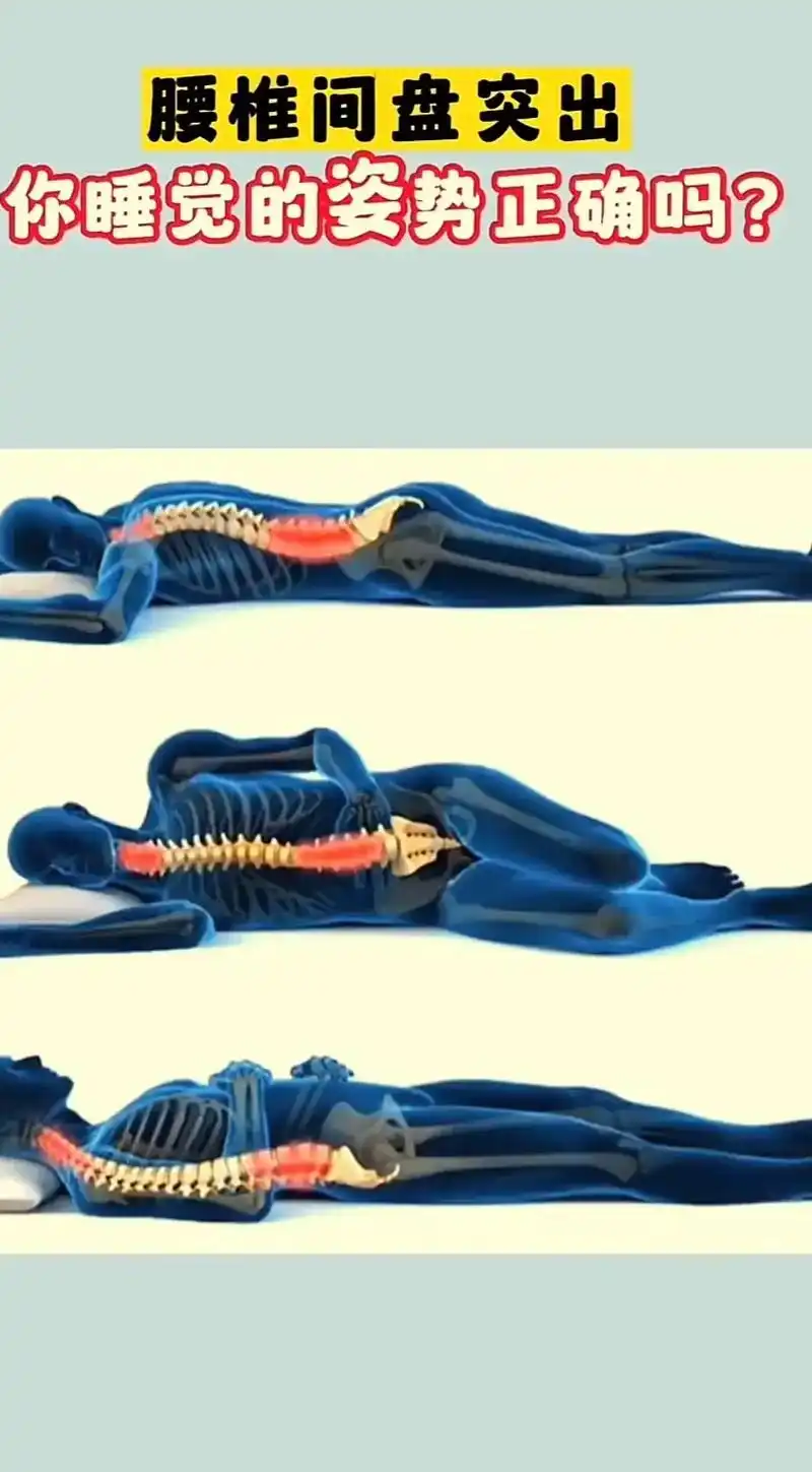 你睡觉的姿势正确吗? 二,仰躺睡 三,侧着睡 膝盖弯下面放一 - 抖音
