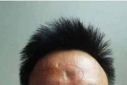 相学里"心术不正"的五种面相