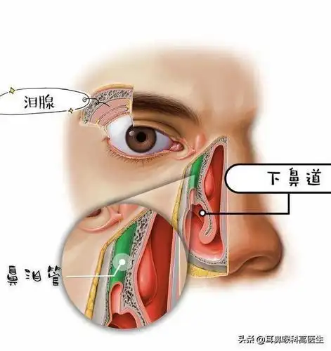 四十年的眼科顽疾被耳鼻喉科医生治疗好了,是怎么回事?