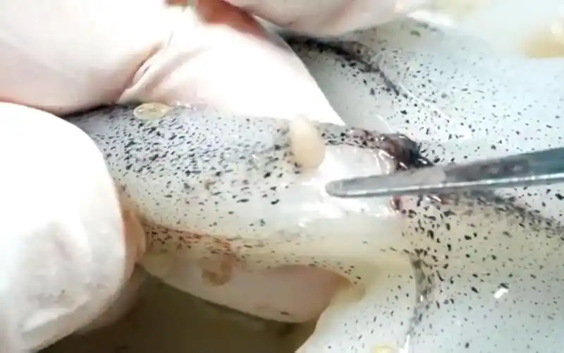 你真的还敢吃鱿鱼吗?全身都有寄生虫!