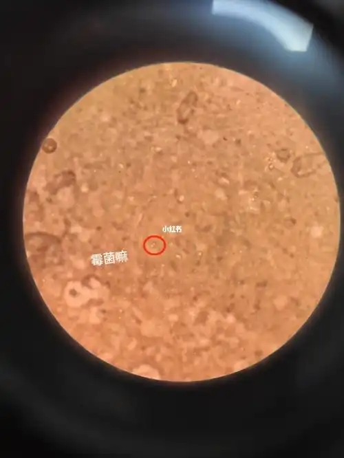 检验科白带显微镜镜观