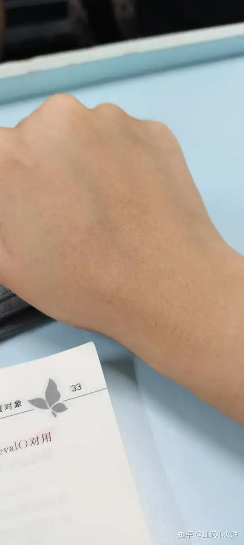 手上长了许多斑这是怎么回事呢