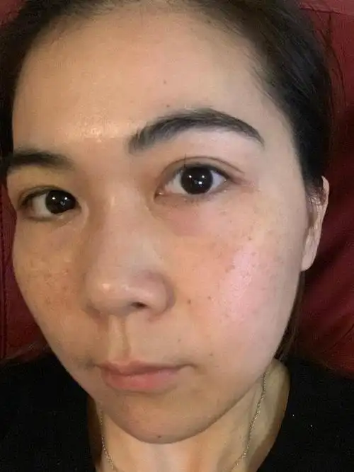 脸上为什么长斑长斑又该怎么去应对这几点注意一下会好很多