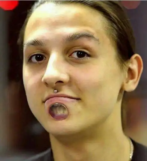 世界上最恐怖的手术分舌手术最吓人将舌头分成两半