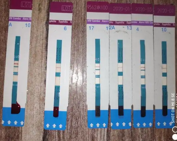 直接把手按在艾滋试纸上会感染吗