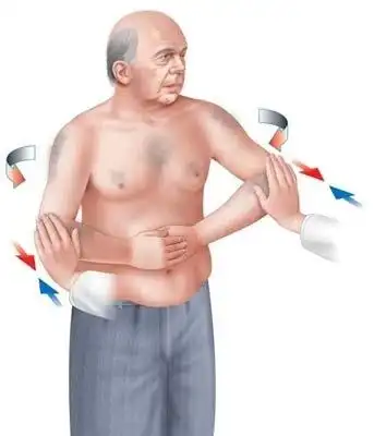 我肩关节摔伤肩膀疼痛肩袖损伤拿破仑试验阳性是什么意思呀?