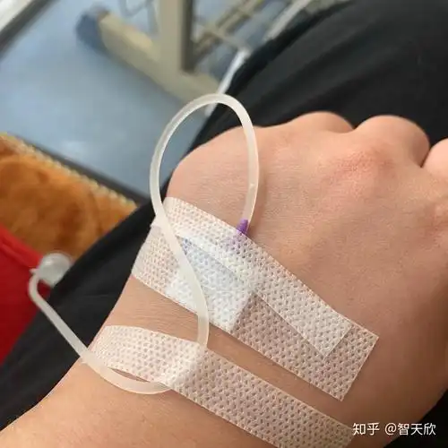 有没有输液的照片我给老师请的病假她要我发照片给她