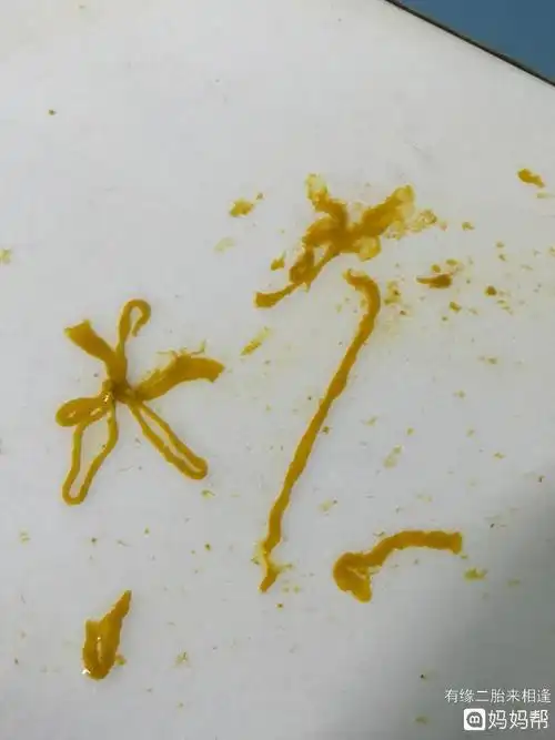 大便凹槽形状图片,大便有凹槽一定是长东西了吗