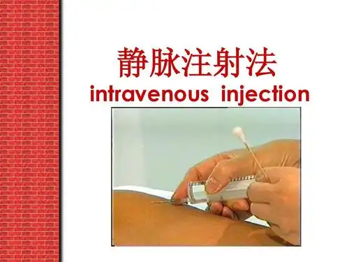 静脉注射法.ppt