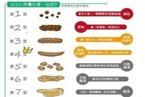 宝宝大便小百科吃母乳婴儿正常大便图附图解2