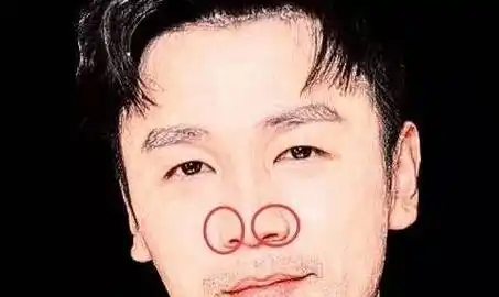 山根低鼻头有肉的男人_鼻头有肉的男人_男人鼻头痣相最准图