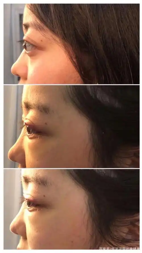 顶着金鱼眼过日子是一种怎么样的体验?