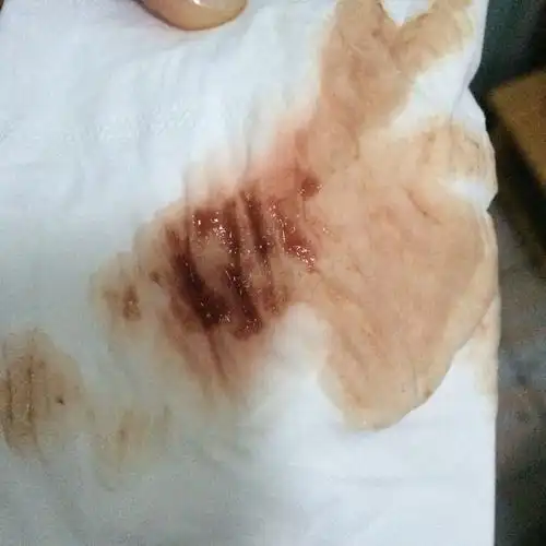 怀孕49天了胎牙和心管搏动都好的,就是小便后用纸有咖啡色的像血,昨天