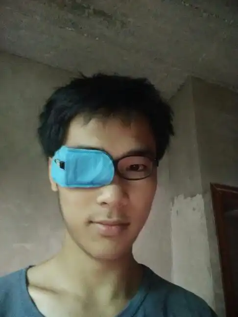 我是男生20岁,我这个斜视用手机竖着照相,看起来又不是很严重,把手机