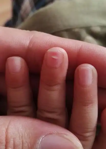 宝宝指甲上的白点是什么呢