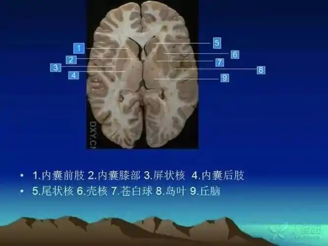 入门必备:头颅 mri 断层解剖