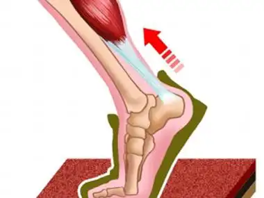 跟腱炎患者的自我护理