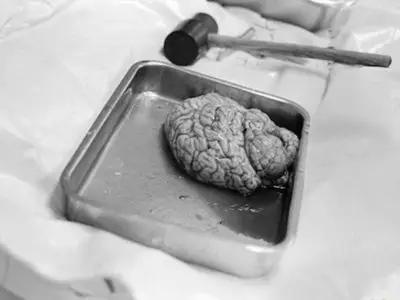 尸体也能说话 法医尸检全过程