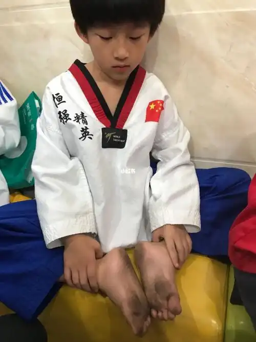 09练完跆拳道的脚呀