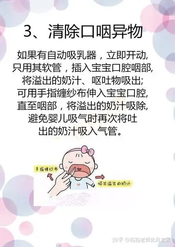 新生儿呛奶家庭紧急护护