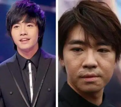 任家萱为什么烧伤任家萱烧伤事件是怎么回事(selina烧伤原因)(图7)