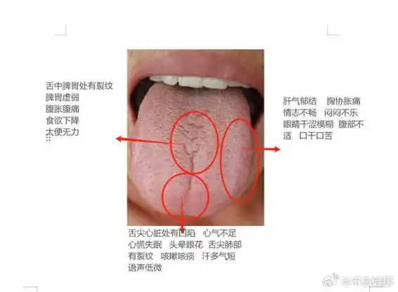 国医的精诚力量##中医舌诊##中医##健康