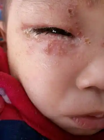 【新手报到】好多孩子得了这病,医生也是没啥招