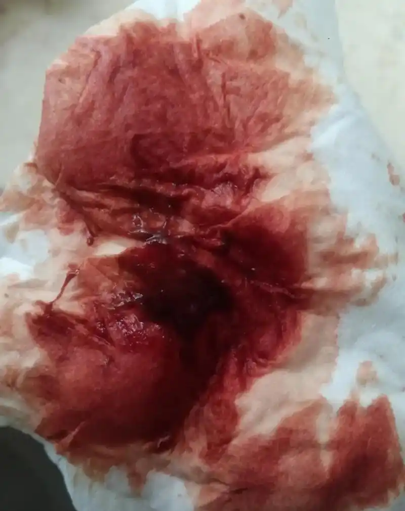 真的无语了.白天坚持上班.晚上回来又开始吐血.为什么这 - 抖音