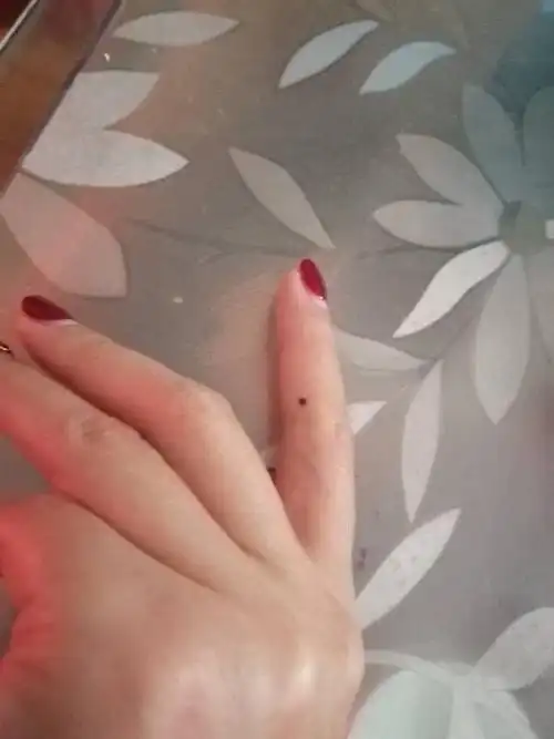 左手食指有这颗痣是什么意思?一般人都注意不到?