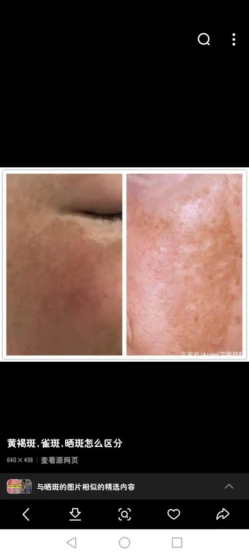 你有没有观察自己脸上晒斑又严重了?