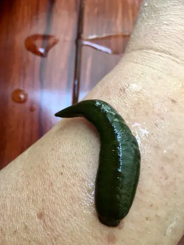 其它 水蛭疗法(手机随拍) 写美篇蚂蟥又名水蛭,金边蚂蝗是世界上众多