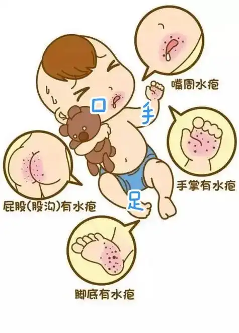 手足口病要来啦2)-手足口病的传播和预防.大家好,我是小猪佩 - 抖音