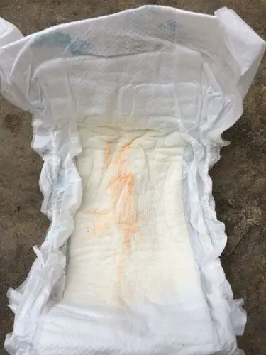 两个多月女宝宝尿不是上有红的 又不像是血是怎么回事?