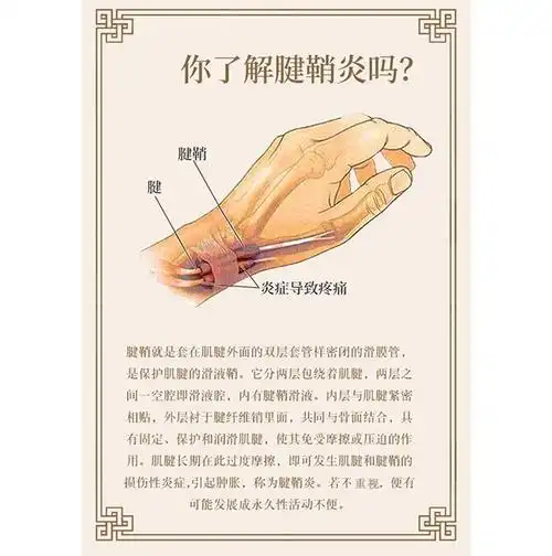 日本腱鞘炎凝胶腱鞘囊肿手腕手指疼痛鼓包网球肘腱鞘护腕专用贴膏关节