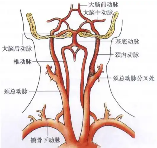 椎动脉出问题可以引起眩晕-胡永珍主治医师-爱问医生