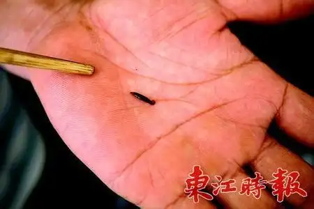 在体表发现很小的线型黑色小虫求为何物,大约有普通缝衣线粗细,最长时