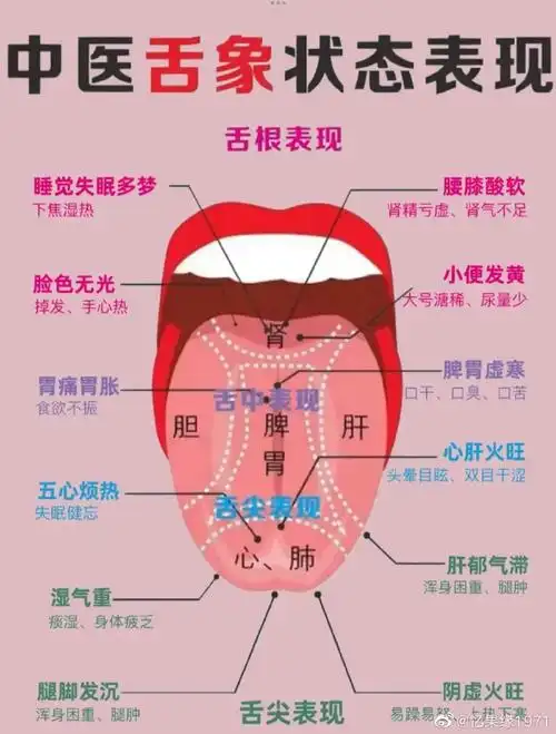 首先正常的舌象,是舌淡红苔薄白的;胃气不足,舌