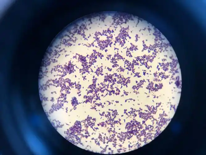 疾控中心检验科食源性疾病质控考核按时完成并顺利通过 - 美篇