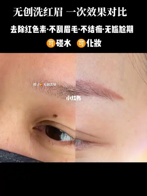 洗红眉一次效果对比不刮眉毛无尴尬期