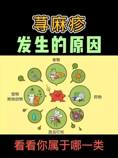 荨麻疹发生的原因你了解了吗