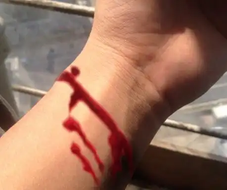 手被刀割了流血图片 - 搜狗图片搜索