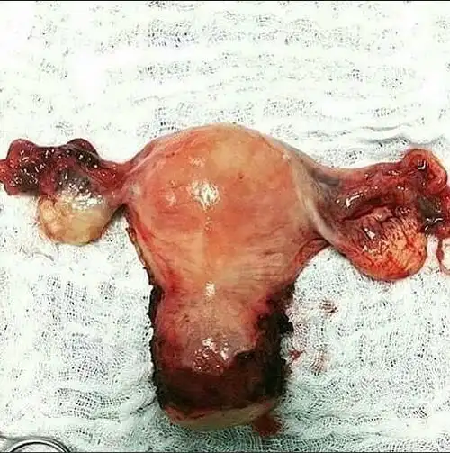 女性的盆腔图片-医学图片-99子宫网