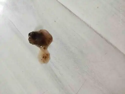 两个月的泰迪狗狗大便这样是什么原因呀,心里很担心,去宠物医院说没啥