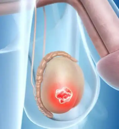 睾丸炎有什么症状 出现这些症状要当心了_美健品招商网